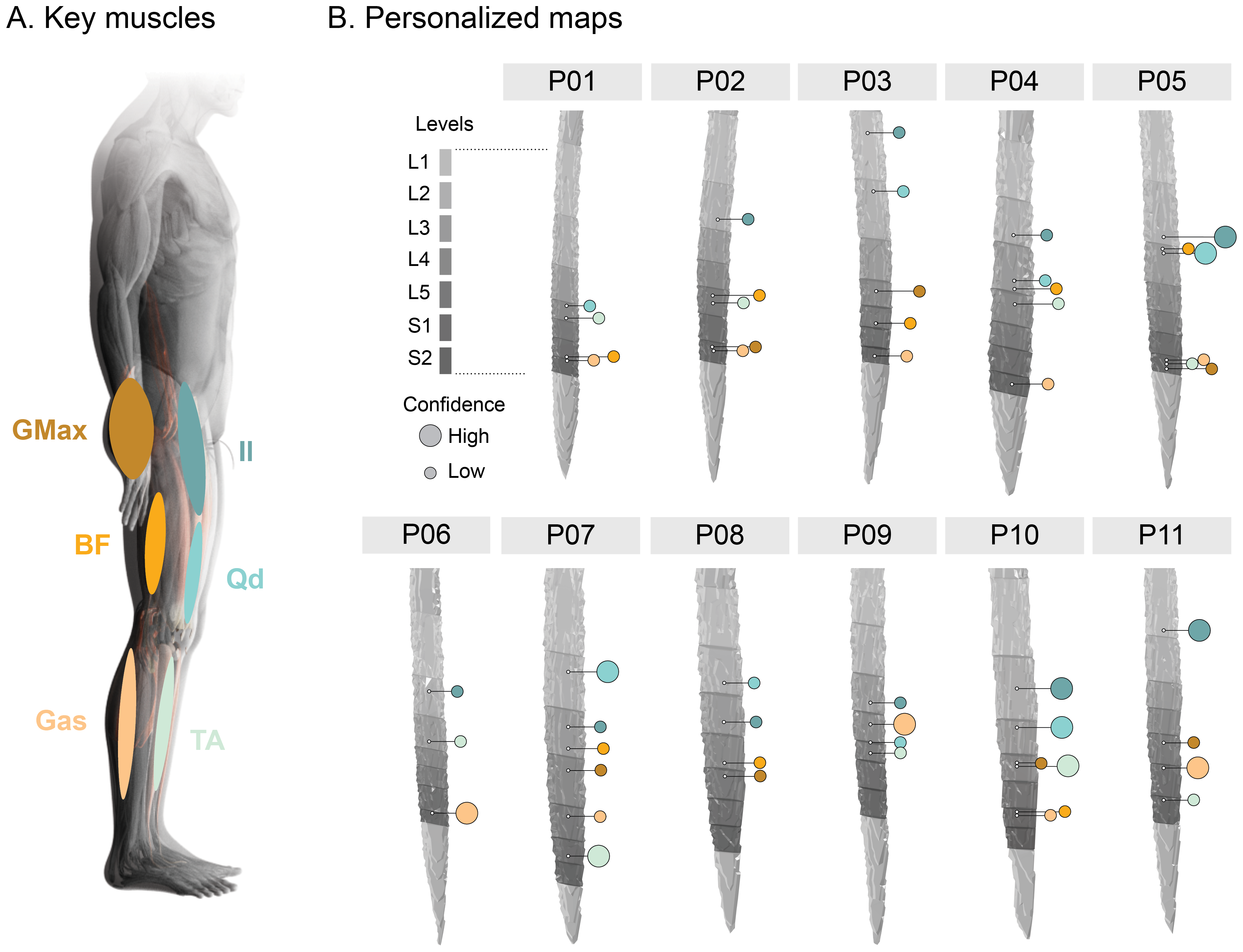 Figure 5 — Lumbosacral spinal cord fMRI activation maps